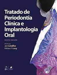 Tratado de periodontia clínica e implantodontia oral